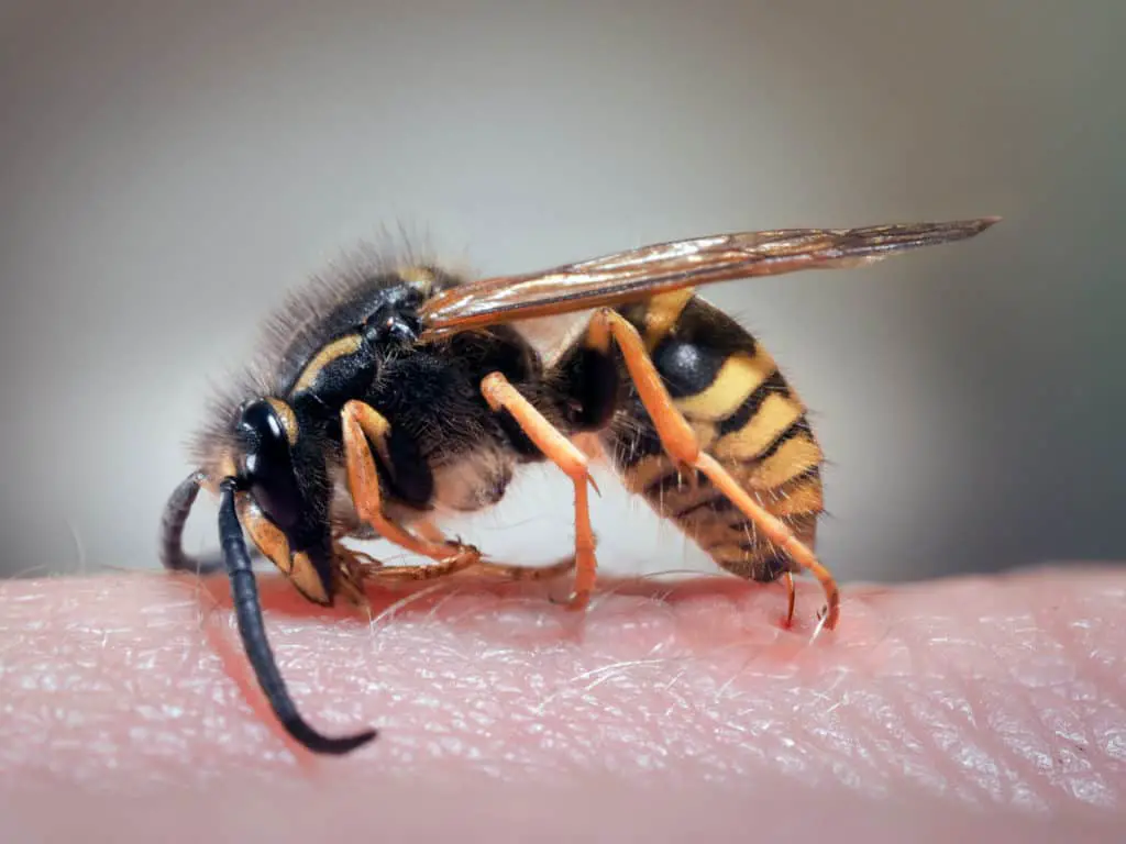 Wasp sting a human hand