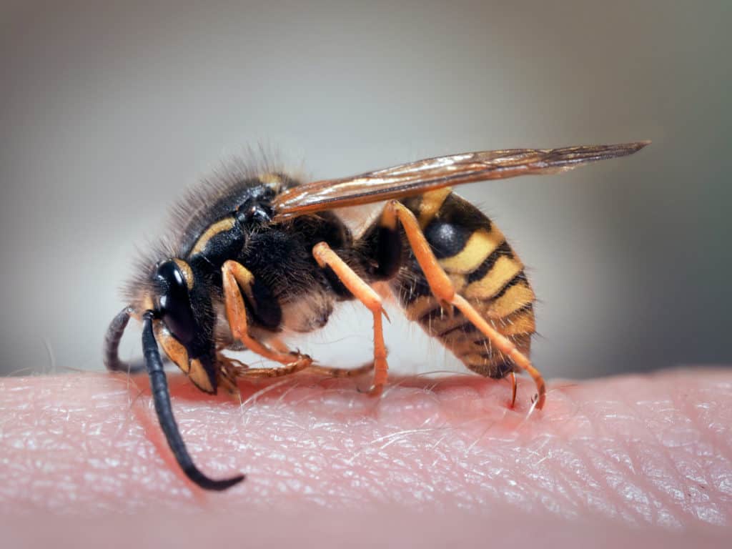 Wasp sting a human hand