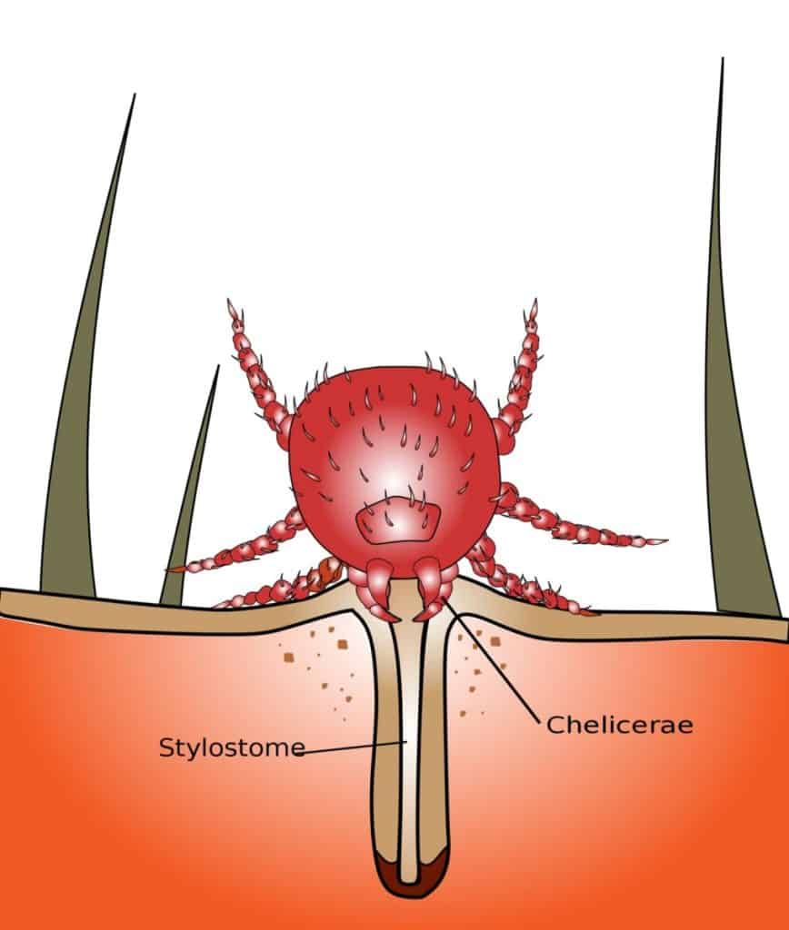 Chigger bite graphic